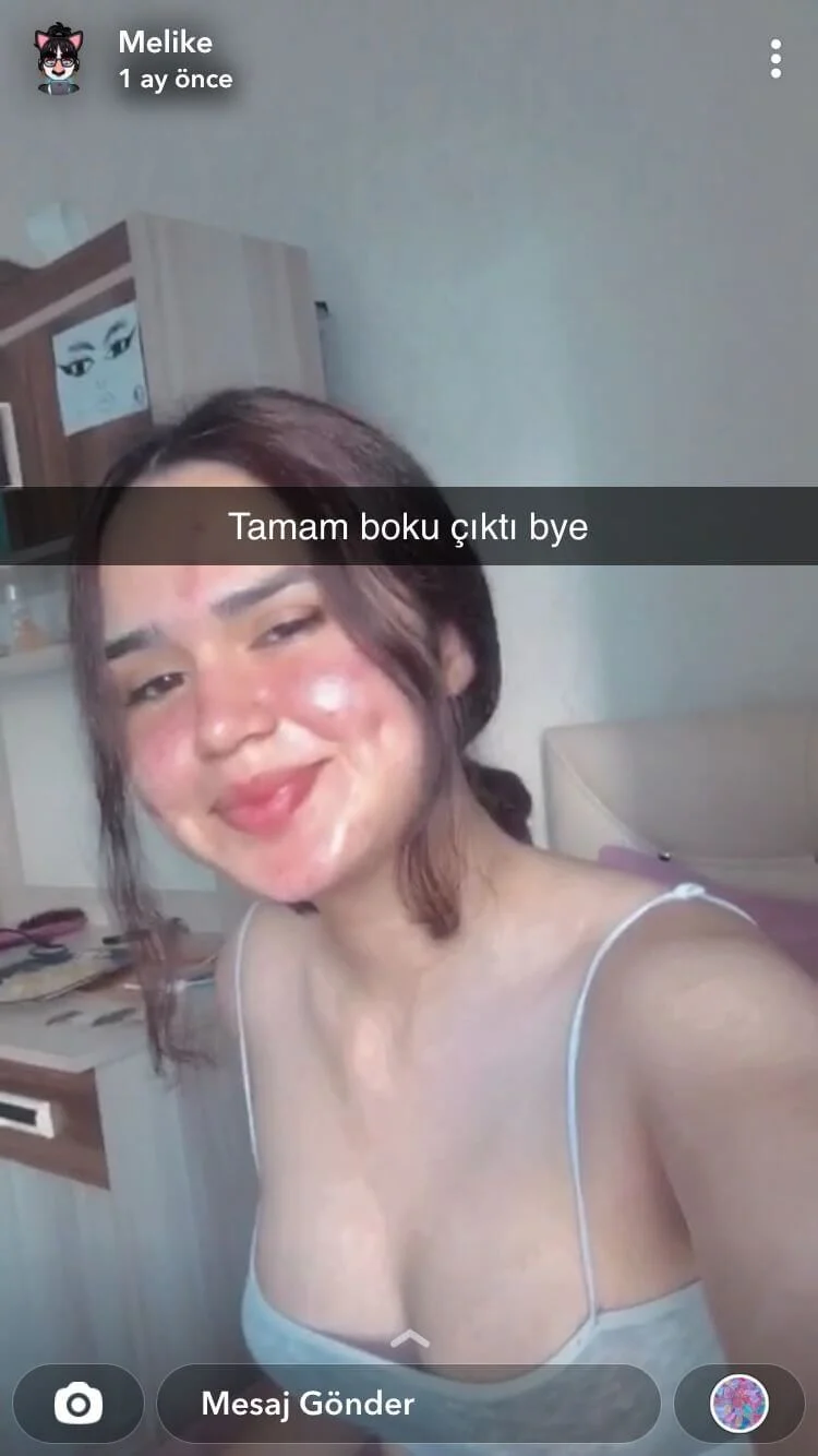 Snapchat Kaşarı Melike