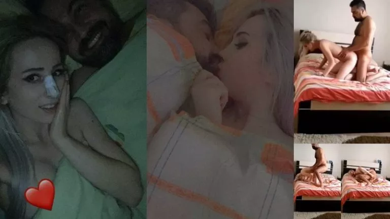 Samsunlu Yeliz Burnunu Yaptirdigi Estetik Doktoruyla Yilin Ifsa Videosunu Cekmisler 6767066a43edd